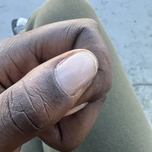 Clear gel polish cured on my skin