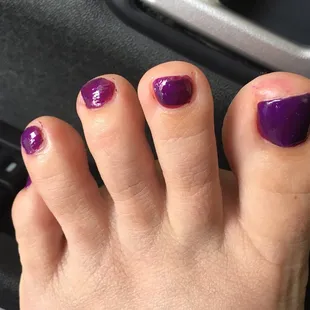 All over my skin and poorly put on my nails.