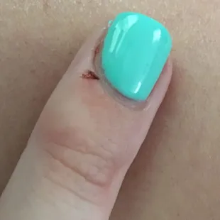 Close up of my nail that got caught when she was grinding down my acrylics and the polish not even close to my skin.
