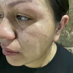 A man beat this woman