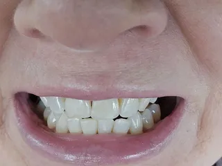 Superior Dental Health