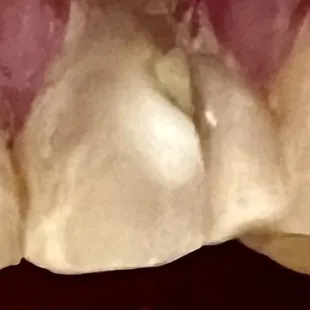 Tooth