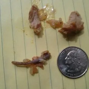 Bone in my kid&apos;s meal.