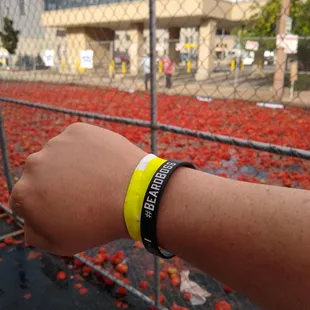 The yellow team won!  Both teams had fun, some got minor injuries, and the few made it on the local news.