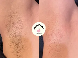 Peachy Glow Aesthetics