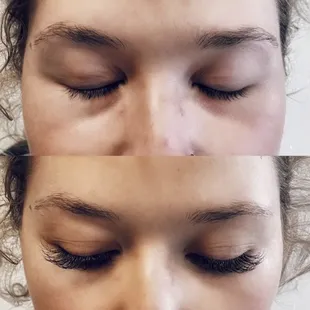 Before and After