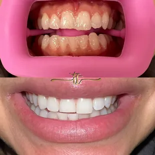 30 min before &amp; after