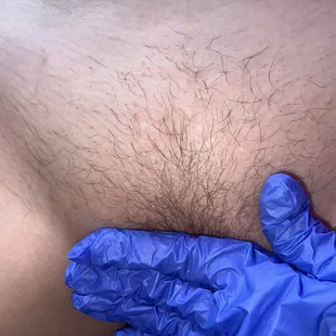 Before Brazilian waxing service