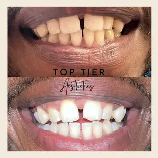 Before &amp; after