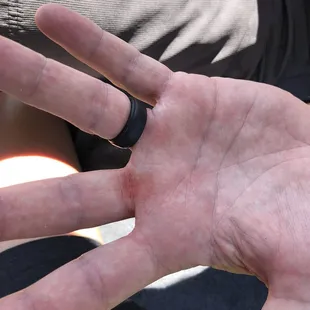 Blood from Mosquitoes