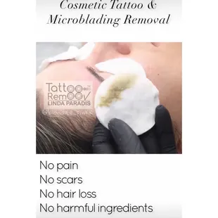 Tattoo removal