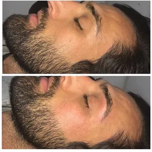 Eyebrow &amp; beard thread. Natural clean up!