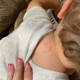 Scratches that I was not informed about