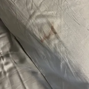 Blood stain on the pillow