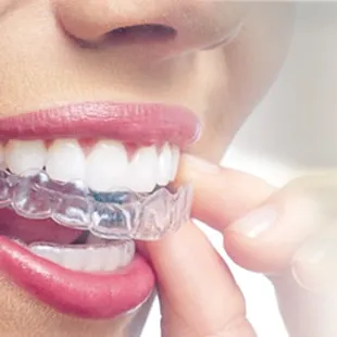We offer Invisalign and Invisalign Teen!