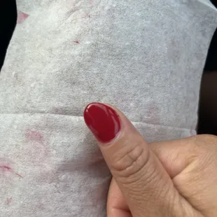 Slanted nail that had a pocket of uncured gel polish that exploded all over the next day