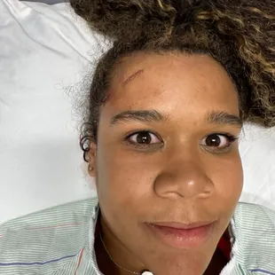 Very neat stitch job, (minimal scaring now)