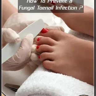 The following habits can help prevent nail fungus:Keep your nails clean and dry. Wash your hands and feet regularly.