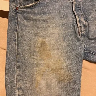 Ruined jeans from waitress dumping katsup on me.