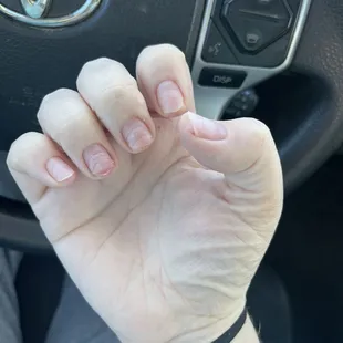 Super short nails and hacked