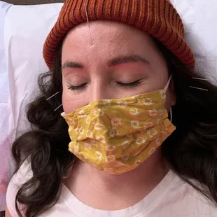 Relaxing during acupuncture session