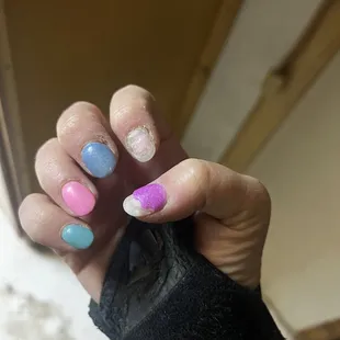 The other hand looks just as bad.