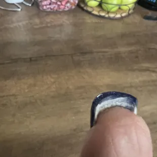 My real nail trashed again on the other hand