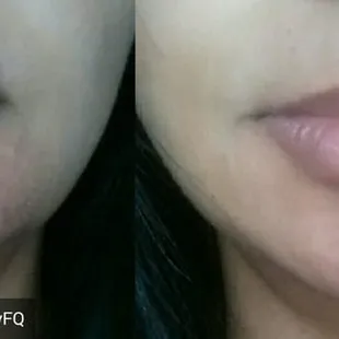 Before and after