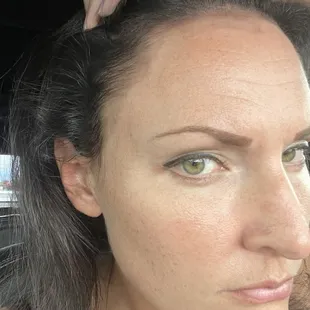 My face with a very obvious color stain