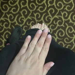 After. Nail shape is shit and he didn&apos;t drill the dip down enough for it to look natural
