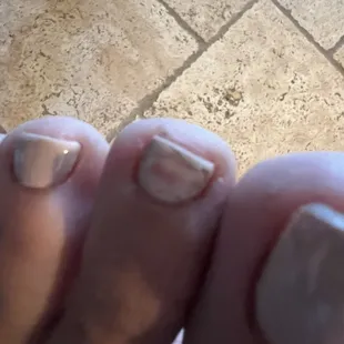 Top polish peeled off