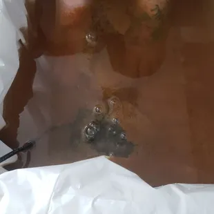 Ionic Detox Session. We use positive and negative ions to draw out toxins through the 2000 pores at the bottom of the feet.