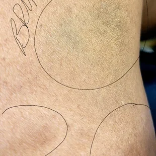 Bruises from the Crazy horse non-ride