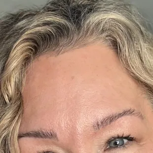 Before  Botox when I thought I needed it