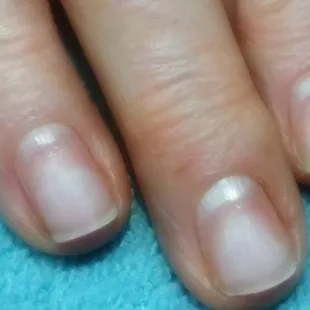 A professional could not remove the gel nails.  Nails were sore and bruised.