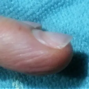 The ground into my natural nails!  No wonder they were bruised and sore!