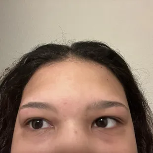 Uneven eyebrows