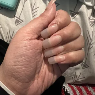 Terrible shape after fixing with no color