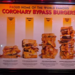 Coronary Bypass Burger