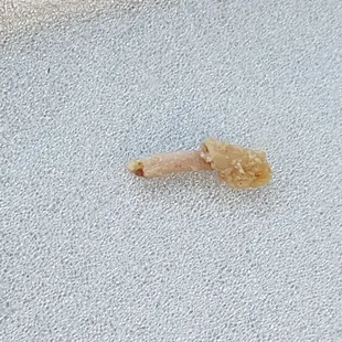 Some type of bone in my omelette