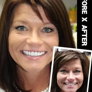Transforming Smiles!
