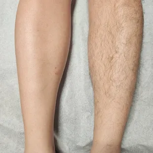 Before and after waxing
