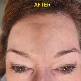 After brow wax