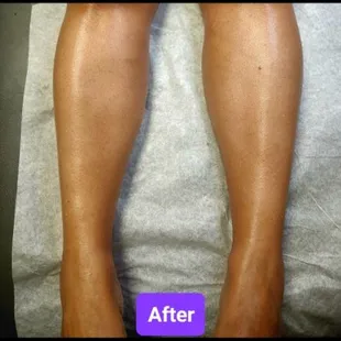 After leg wax
