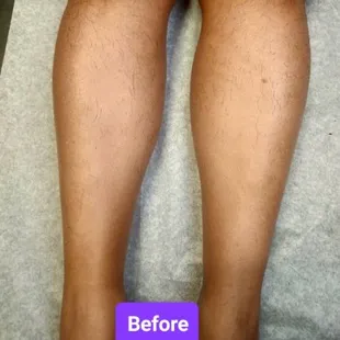 Before leg wax