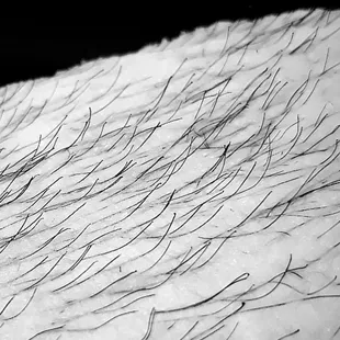 Pulled from the root!