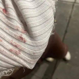 Blood on my shirt after being shoved to the ground by security