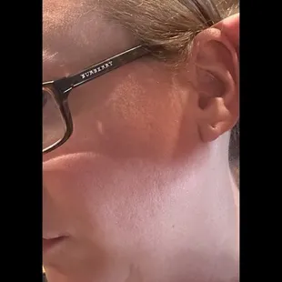bleached frayed hair with dark uneven hair tone