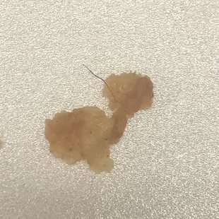 Piece of hair found in fried fish. Right under the skin. Must have fallen into the fish batter.