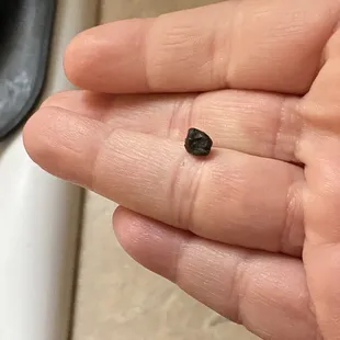 The rock that I bit into when I had the fries.